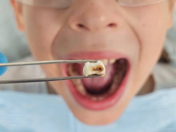 Best Broken Tooth Emergency  in Carlisle, PA